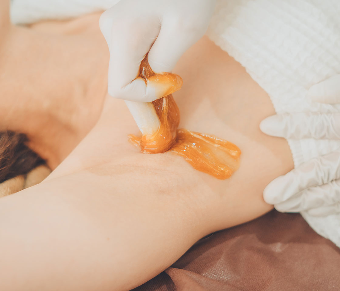 シュガーリング脱毛